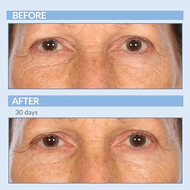 Serious Skincare - Retinol Vitamin A Eye XR Under Eye Cream Concentrate - Reduce Fine Lines, Dark Circles & Puffiness - Da...