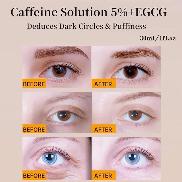 Caffeine Solution 5% + EGCG, Caffeine Eye Serum For Face, Moisturizing Under Eye Solution For Reduces Dark Circles & Puffi...