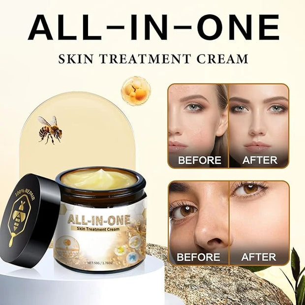 2Pcs All-In-One Skin Cream,Bee Venom Cream, New Bee Venom Cream, Professional Bee Venom Repair Cream, Natural Skin Moistur...