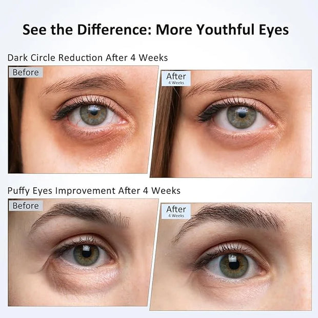 Caffeine Eye Cream for Dark Circles, Puffiness & Puffy Bags - Under Eye Serum with Caffeine, Niacinamide, Hyaluronic Acid,...