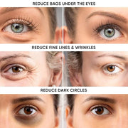 Instant Puffy Eye & Lift Treatment – Removes Under Eye Bags & Puffiness. Eliminate Dark Circles & Wrinkles. Naturally Agel...