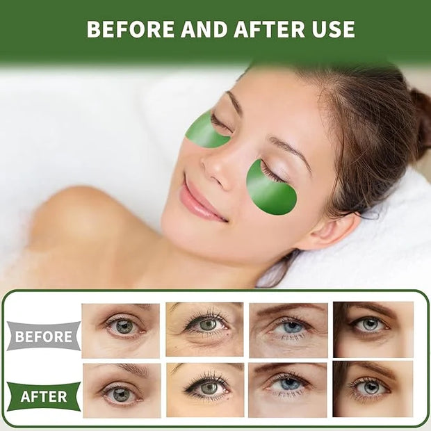 Under Eye Patches 70PCS, Green Tea Eye Patches for Puffy Eyes Treatment, Under Eye Masks for Dark Circles and Puffiness, N...