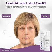 Beverly Hills Instant Facelift Anti Aging Eye Serum Treatment for Dark Circles, Puffy Eyes, Wrinkles, Under Eye Bags, Fine...