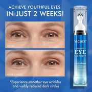 5% Caffeine Peptide Eye Serum, Under Eye Roller Cream for Dark Circles, Puffiness, Bags Under Eyes - 360° Massage Ball Cre...