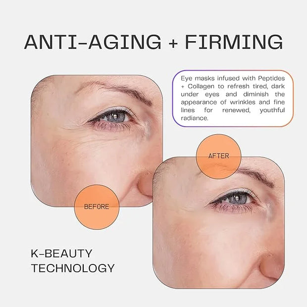 Collagen Under Eye Mask Patches (Anti-Aging + Firming 20 Pairs) with Niacinamide + Peptides - Anti-Aging, Fine Lines, Wrin...