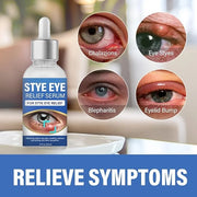 St＿ye Eye Treatment, Natural Eye Serum for Chalazion and Blepharitis Treatment, Leading to Soothed and Restored E-ye Areas...