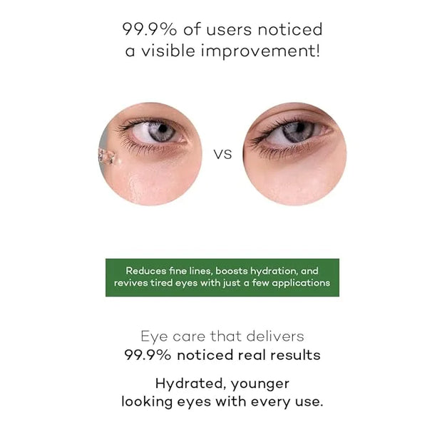 Collagen Hyaluronic Acid Serum; Reduces Dark circles, Puffy Eyes, Wrinkles, Under Eye Bags, Fine Lines. Anti-Aging, Hydrat...