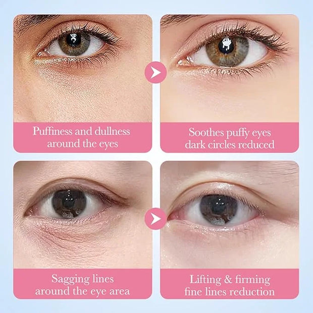 Under Eye Patches - 60 Pcs Eye Mask Anti-Aging Collagen Hyaluronic Acid Moisturizing Under Eye Mask for Removing Dark Circ...
