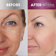 Retinol Anti-Aging Eye Stick – Hydrates, Firms, Brightens, and Smooths Fine Lines Anti-Aging Sheet Mask – Hydrating Vitami...