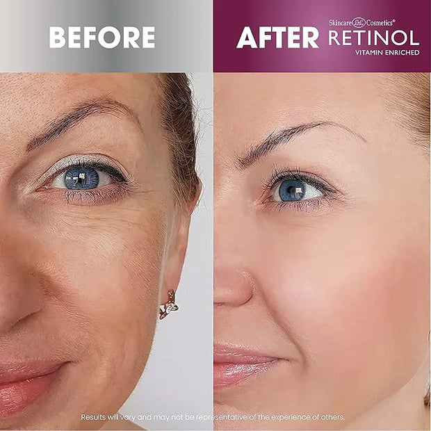 Retinol Anti-Aging Eye Stick – Hydrates, Firms, Brightens, and Smooths Fine Lines Anti-Aging Sheet Mask – Hydrating Vitami...