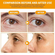 Vitamin C Eye Cream Puffiness Remover Eye Serum Anti-aging & Moisturising Vitamin C Eye Serum Eye Bags Treatment for Men a...