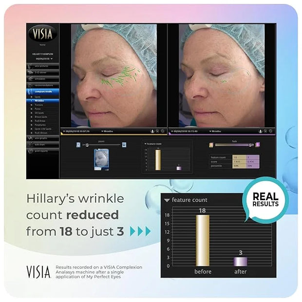 My Perfect Eyes by Penny Lane | Anti-Aging Eye Cream for Dark Circles & Puffiness | Instant Firming Treatment for Wrinkles...