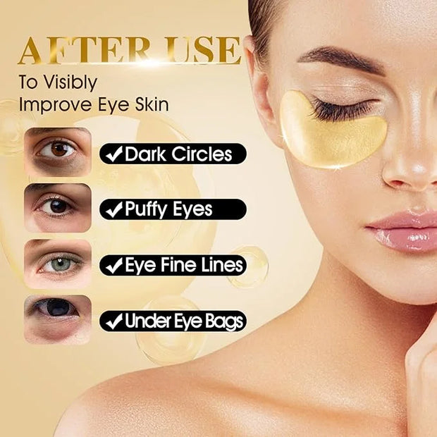 VESPRO 120 PCS 24K Gold Under Eye Patches for Dark Circles and Puffy Eyes, Eye Mask With Collagen and Hyaluronic Acid for ...