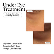 MATKAS Korean Vitamin C & Caffeine Eye Cream for Dark Circles and Puffiness 0.5 Fl Oz - Dark Circles Under Eye Treatment, ...