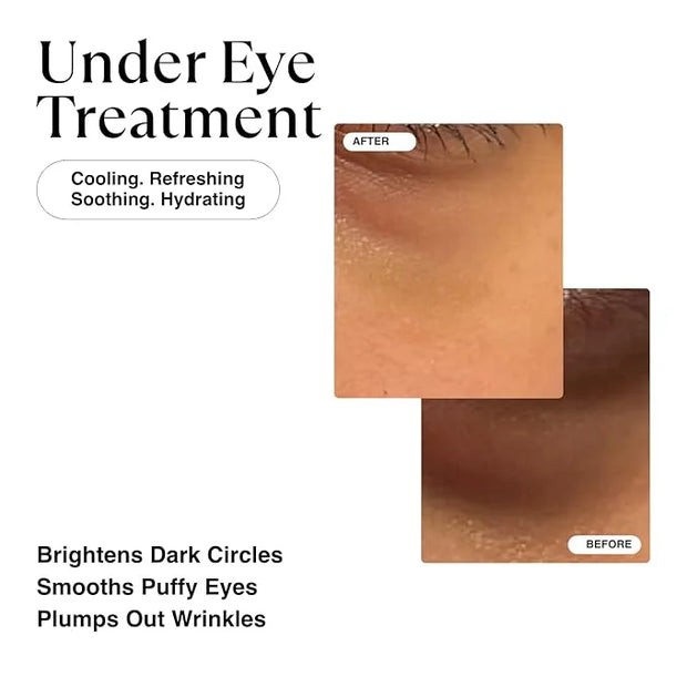 MATKAS Korean Vitamin C & Caffeine Eye Cream for Dark Circles and Puffiness 0.5 Fl Oz - Dark Circles Under Eye Treatment, ...