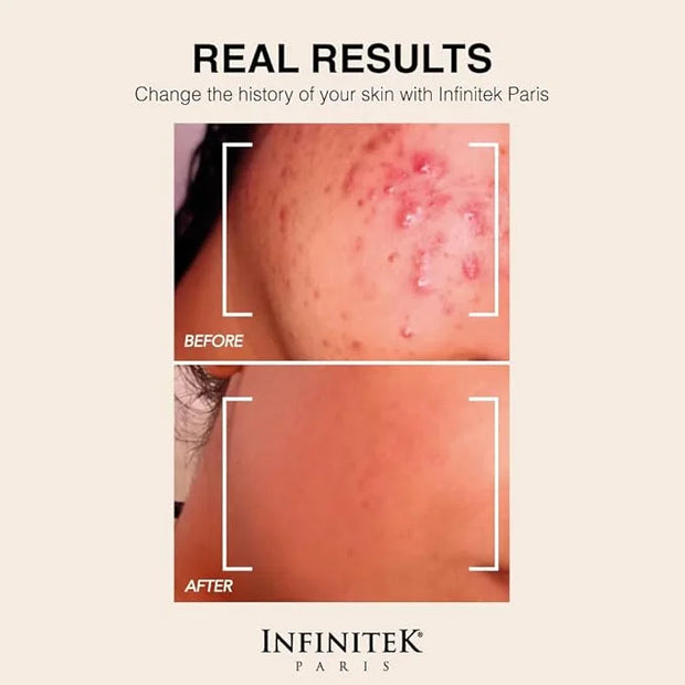 Infinitek Paris Retinol Face Moisturizer Night Cream - Premium Skin Care with Collagen & Vitamin E. Advanced Anti-Aging an...