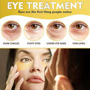 Under Eye Patches, 24K Gold Eye Patches for Puffy Eyes and Dark Circles, Under Eye Masks for Dark Circles and Puffiness, E...