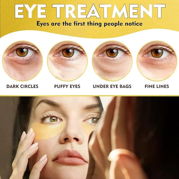 Under Eye Patches, 24K Gold Eye Patches for Puffy Eyes and Dark Circles, Under Eye Masks for Dark Circles and Puffiness, E...