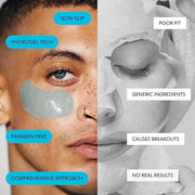 LOOPS Hyper Smooth Eye Hydrogel Eye Mask - 5 Pc Brighten, Hydrate, Nourish and Help Reduce Dark Circles for Refreshed Eyes...