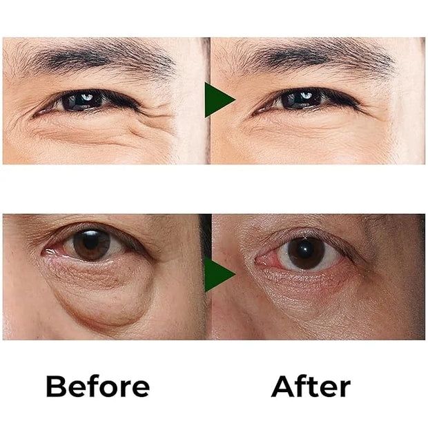 Abera Eye Roller Serum with Mint Essence for Men, Vitamin C and Peptides - Energizing Serum for Dark Circles and Puffiness...