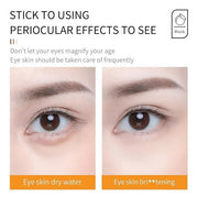 YP Eye Cream Under Eye Bags for Delicate Eye Area - Vitamin C Infused Formula Targets Tired Eyes, Puffiness & Skin Vitalit...