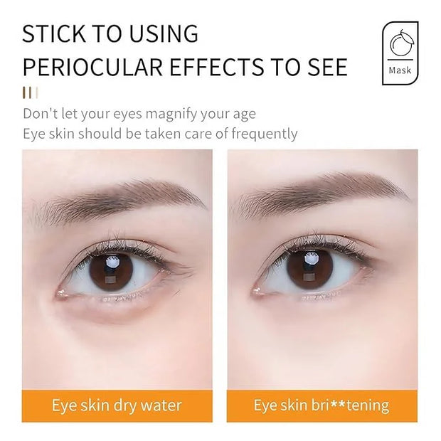 YP Eye Cream Under Eye Bags for Delicate Eye Area - Vitamin C Infused Formula Targets Tired Eyes, Puffiness & Skin Vitalit...