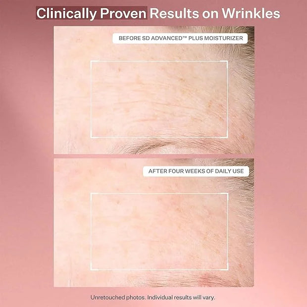 StriVectin Anti Wrinkle Trio Kit for Face and Eyes, 3 piece kit with SD Plus Moisturizer, Peptide Plump Line Face Serum, a...