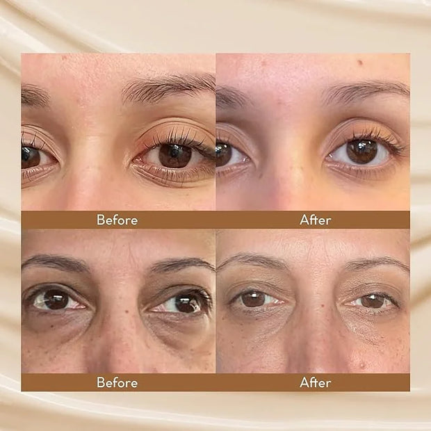 Caffeine Eye Cream for Dark Circles: Under Eye Serum for Puffiness Bags Wrinkles Fine Lines - Anti Aging Firming Tightenin...