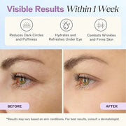 LilyAna Naturals Eye Cream for Dark Circles and Puffiness, Under Eye Cream for Wrinkles and Bags, Anti Aging - helps Impro...