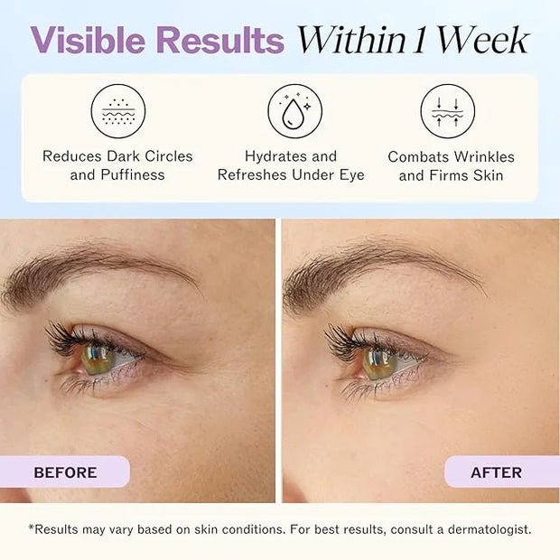 LilyAna Naturals Eye Cream for Dark Circles and Puffiness, Under Eye Cream for Wrinkles and Bags, Anti Aging - helps Impro...