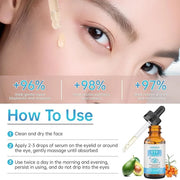 Eye Serum For Chalazion & Blepharitis Treatment, 2 PCS Chalazion Remover For Eyelid Treatment, Eyelid Serum With Avocado O...