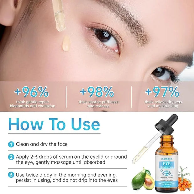 Eye Serum For Chalazion & Blepharitis Treatment, 2 PCS Chalazion Remover For Eyelid Treatment, Eyelid Serum With Avocado O...