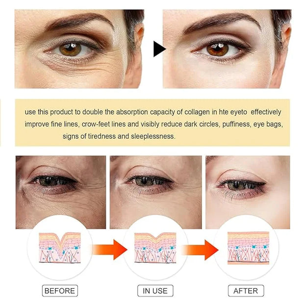 24K Gold Eye Masks, Crystal Collagen Eye Patches for Puffy Eyes, Reducing Fine Lines, Effectively Moisturizing Gold Eye Ma...