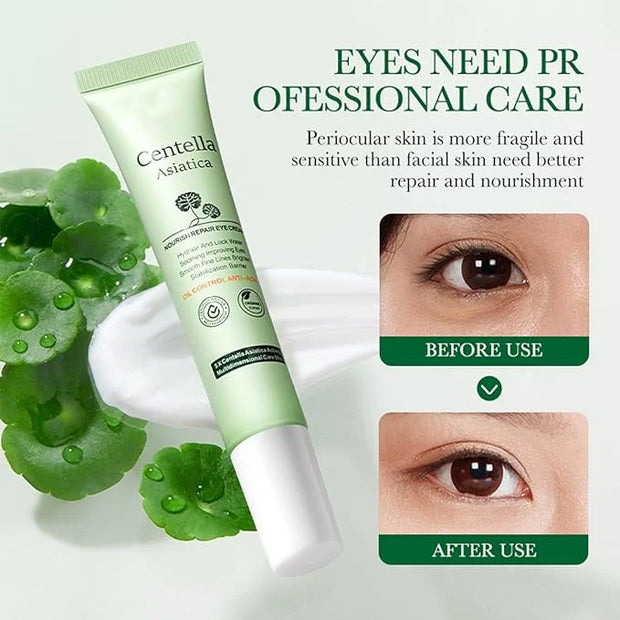 Centella Asiatica Eye Cream,Moisturizes and Tightens the Skin Around the Eyes,Reduces Dry Lines and Fine Lines,Improves Da...