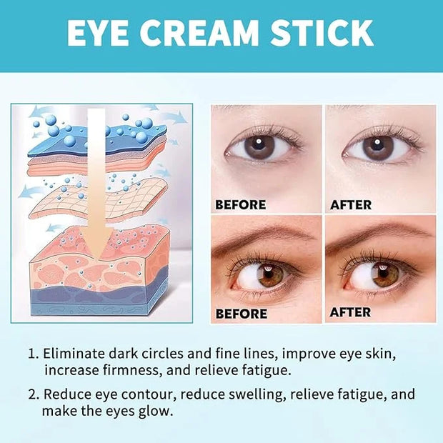 Anti-Aging Eye Cream for Wrinkles Under Eye Cream with Snail Mucin for Fine Lines Puffiness - Firming Eye Serum Relieve Ey...