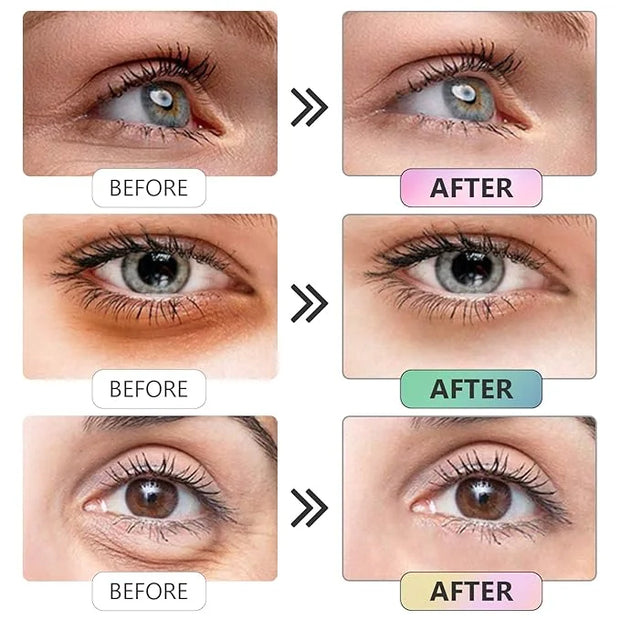 Under Eye Patches -30 Pairs Sakura Essence Eye Mask Eye Pads for Puffy Eyes, Reducing Dark Circles, Anti-Aging, Collagen E...