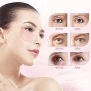 Under Eye Patches (30 Pairs), Eye Mask for Puffy Eyes, Dark Circles,Bags and Wrinkles with Collagen,Relieves Pressure and ...