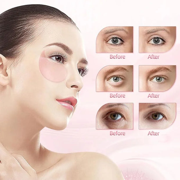 Under Eye Patches (30 Pairs), Eye Mask for Puffy Eyes, Dark Circles,Bags and Wrinkles with Collagen,Relieves Pressure and ...