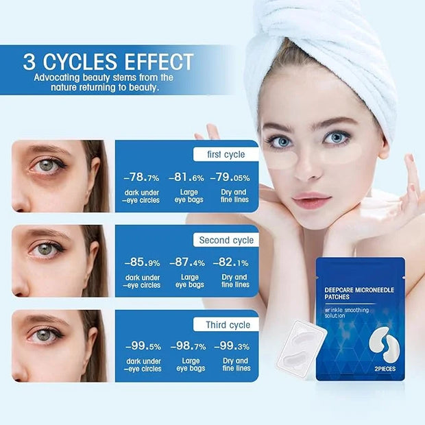 Malora Microglow Eye Patches, Malora Eye Patch, Microglow Patches, Everver Glowup Deep Care Microglow Patches, Women Face ...