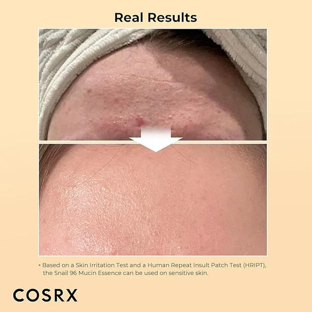 COSRX Best Seller Duo- Snail 92 Cream & Snail 96 Essence, Daily Face Gel Moisturizer and Hydrating Serum for Face with Sna...