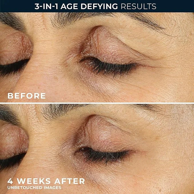 RoC Retinol Correxion Eye Cream Mini for Dark Circles & Puffiness, Daily Wrinkle Cream, Anti Aging Line Smoothing Skin Car...
