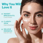 ZealSea 10% Azelaic Acid Facial Cream - Azelaic Acid Serum with AHA for Face, Relief Pimple, Breakouts, Blackhead & Rednes...