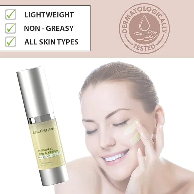 Epic Organic Eye Cream - Vitamin K & Arnica - Naturally Reduces Wrinkles, Under Eye Bags, Puffiness, Dark Circles & Fine L...