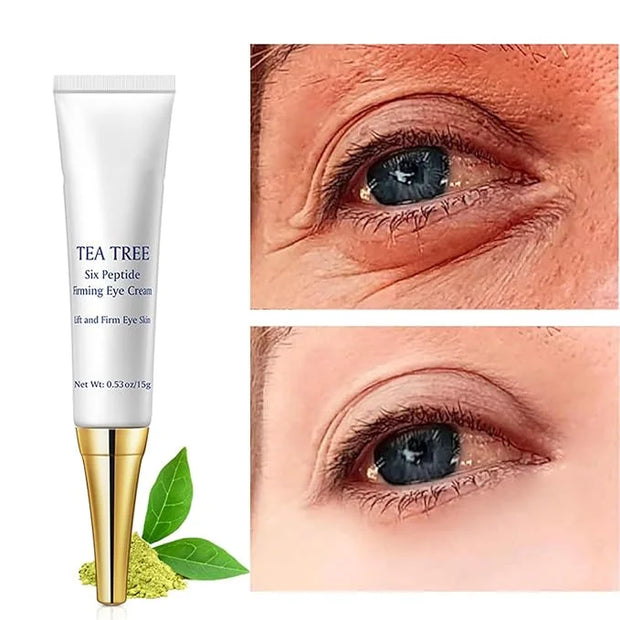 Eye Cream for Dark Circles Under Eye Cream for Puffiness and Bags Tea Tree Six Peptide Fiming Anti-Aging Eye Cream for Wri...