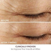 Dr. Dennis Gross Advanced Retinol + Ferulic Eye Serum – Target Dark Circles, Puffiness, Fine Lines & Wrinkles for Smooth, ...