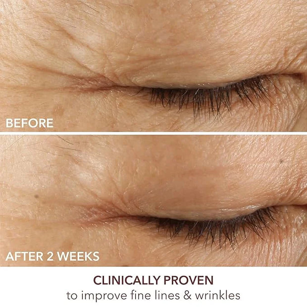 Dr. Dennis Gross Advanced Retinol + Ferulic Eye Serum – Target Dark Circles, Puffiness, Fine Lines & Wrinkles for Smooth, ...