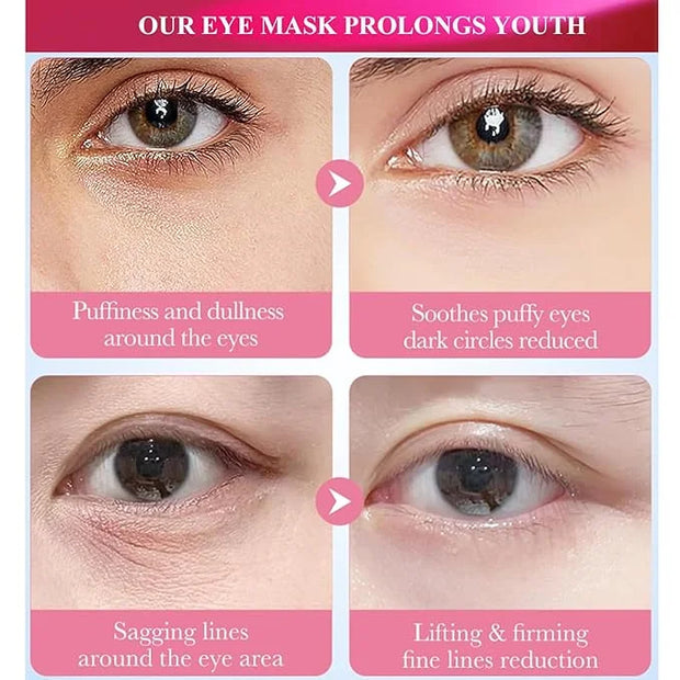 Under Eye Mask Patches, 30 Pairs Collagen Hydrating Moisturizing Smoothing Gel Pads for Puffy Eyes Bags,Dark Circles,Puffi...