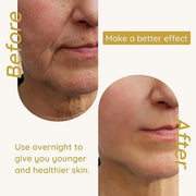 Enaskin Naturals Anti Wrinkle Face Patches Anti Wrinkle Gel Face Masks (1 Pack) - Product Image