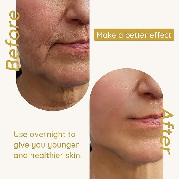 Enaskin Naturals Anti Wrinkle Face Patches Anti Wrinkle Gel Face Masks (1 Pack) - Product Image