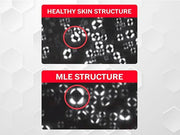 ATOPALM | Intensive Moisturizing Cream | Face & Body Moisturizer | For Dry & Sensitive Skin | Paraben-Free Lotion | Replen...